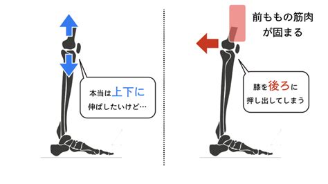 バレエで「膝が伸びない」とは？3つの原因とレッスン中できる対策 バレエダンサーさんの治療院