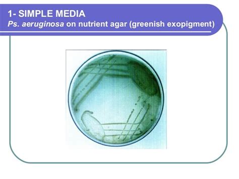 Microbiology Culture Media Chart