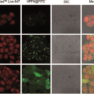 A CLSM Images Of HeLa Cells Treated With HPFN FITC For Different