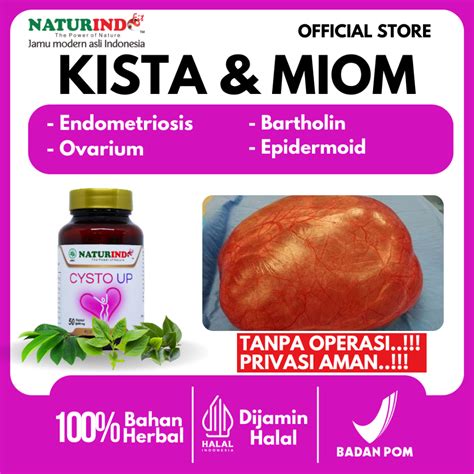 Jual Obat Kista Miom Bartholin Ovarium Kista Endometriosis Herbal Ampuh