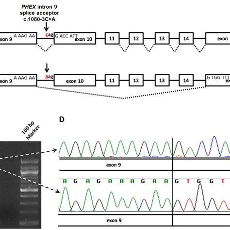 Rt Pcr Analysis Of The Mutated Phex C A Acceptor Splice Site A