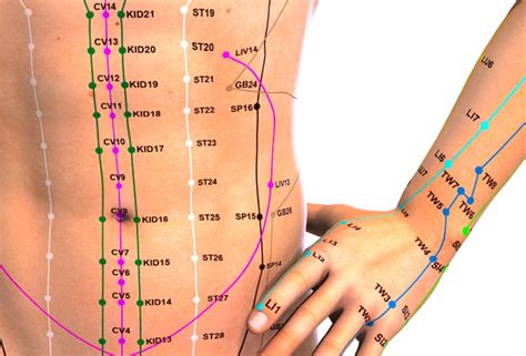 Acupuncture Found Effective For Endometriosis