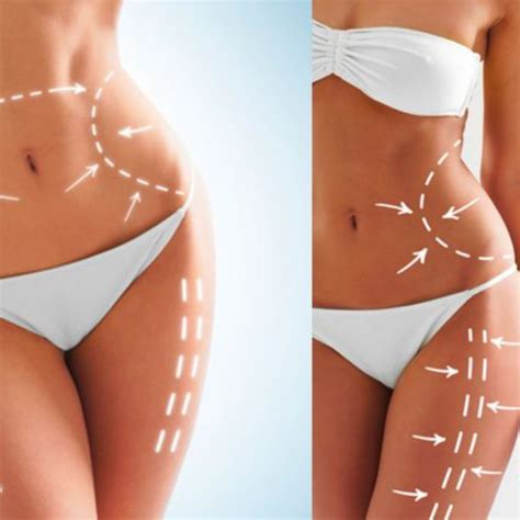 Lipo Enzimática Corporal OZ CLINIC Ex EO Clínica Medicina