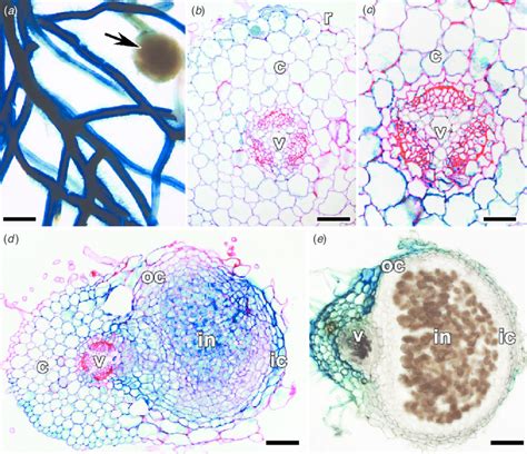 Histochemical Analysis Of Gus Activity In Transgenic Lotus Japonicus