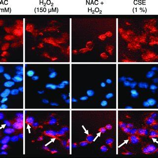 Nucleocytoplasmic Shuttling Of SIRT1 By Oxidative Stress Is Reversed By