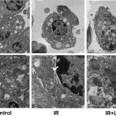 The Ultrastructure Of Cells Through Transmission Electron Microscopy On