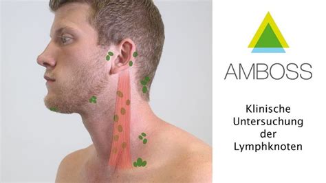 Lymphknoten Klinische Untersuchung AMBOSS Video