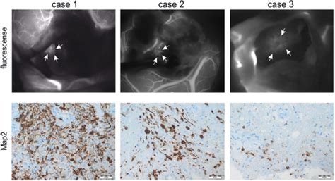 Dual Intraoperative Visualization Approach Surgery A Novel