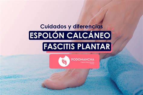 Cuidados y diferencias entre espolón calcáneo y fascitis plantar