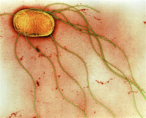 Salmonella Enteritidis Bacterium Photograph By A Dowsett Public