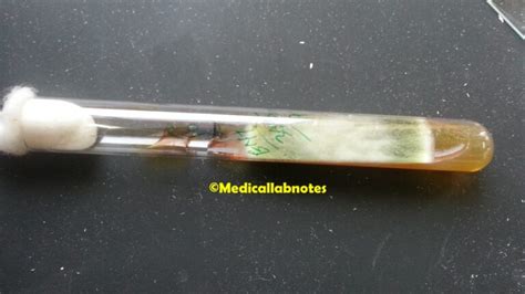 Aspergillus Fumigatus Introduction Morphology Pathogenicity Lab