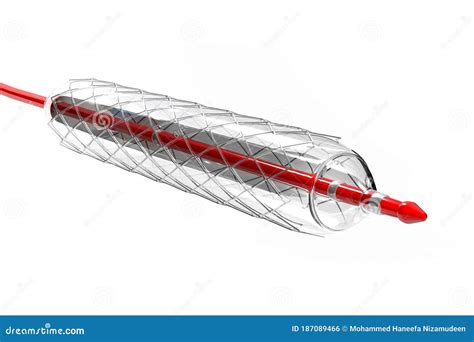 stent  balloon angioplasty stock photography cartoondealercom