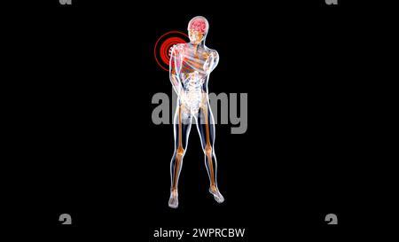 Shoulder Pain Conceptual Illustration Stock Photo Alamy