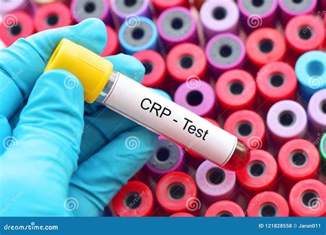 C Reactive Protein Test Stock Photo Image Of Diagnosis