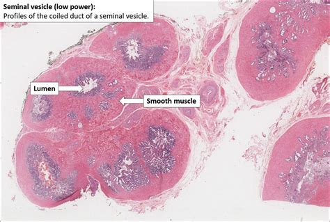 Seminal vesicle – Normal Histology – NUS Pathweb :: NUS Pathweb