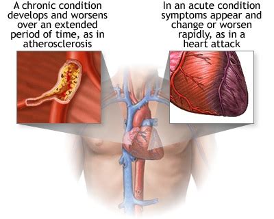 Chronic Conditions Definition Management And The Pharmacist Role