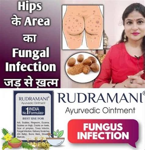 Rudramani Malam Ointment For Ayurvedic Packaging Size 25 Gm At Rs