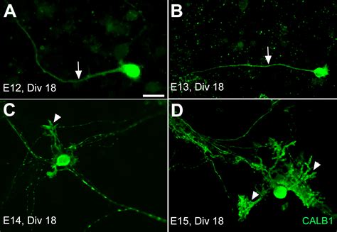 Primary Culture Of Neurons Isolated From Embryonic Mouse Cerebellum