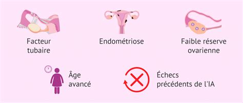 Indications De Fiv Pour L Infertilit F Minine