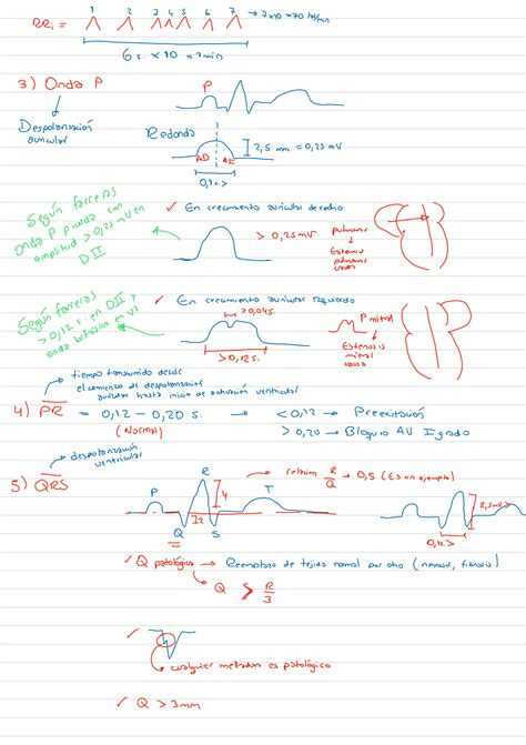 Solution Electrocardiograma Ekg Studypool