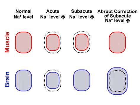 Cell Volume In Acute Or Subacute Hypernatremia And Following Rapid