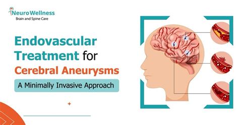 Cerebral Aneurysm Treatment Minimally Invasive Repair With