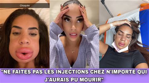 Marwa D Figur E Apr S Une Injection Elle Explique Ce Qui S Est Pass E