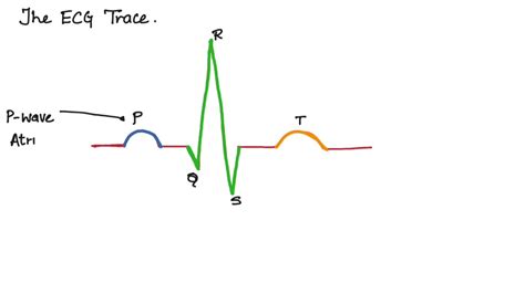 Normal Ecg Tracing