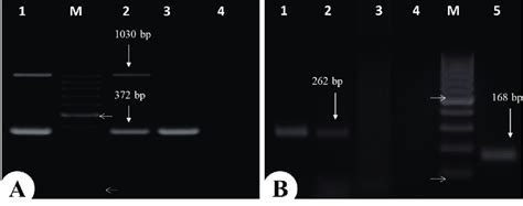 A The Pcr Results Showing Positive Amplifi Cation For S Rrna And