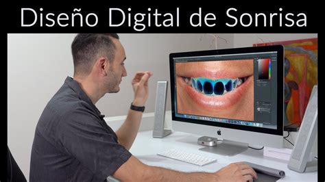 C Mo Se Hace Un Dise O De Sonrisa Dise O De Sonrisa Digital Youtube