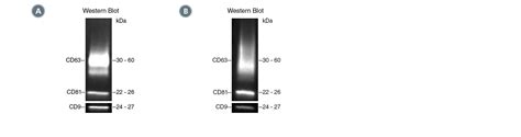 Western Blotting Protocol For Characterizing Extracellular Vesicles