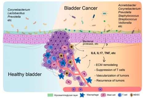 Diagnostics Free Full Text The Urinary Microbiome Role In Bladder Cancer And Treatment