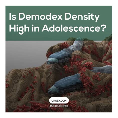 The Benefits Of Ungex S Mite Treatment Besides Killing Demodex Mites