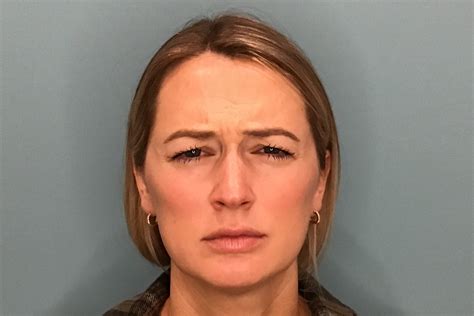 Injectables - Taylor Plastic Surgery