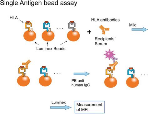 Pdf Hla Human Leukocyte Antigen B27 Typing Positive Pdf Télécharger