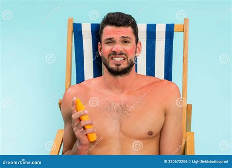 Worried Shirtless Man With Sunburn Holding Stock Photo Image Of