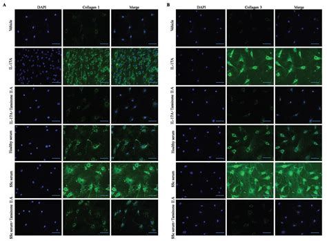 Scielo Brasil Tanshinone Iia Attenuates Interleukin A Induced