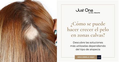 Tratamientos Para Hacer Crecer El Pelo En Zonas Calvas I Just One