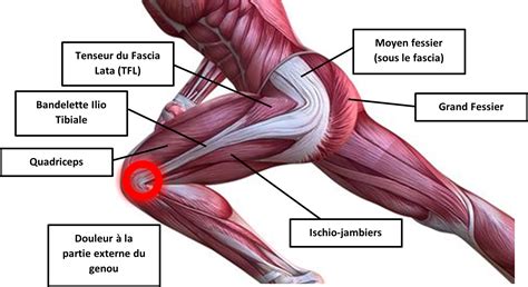Tfl Ou Syndrome De Lessui Glace Douleur Genou Cabinet De Podologie