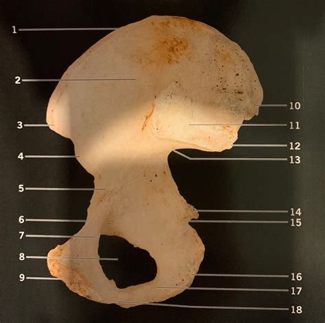 Right Coxal Hip Bone Medial View Diagram Quizlet