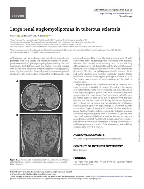 Pdf Large Renal Angiomyolipomas In Tuberous Sclerosis