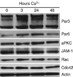 Expression Of Par3 Par6 APKC Complex Components And Associated Proteins