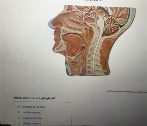 Solved Lt C Haif Head With Musculature The Highlighted Chegg