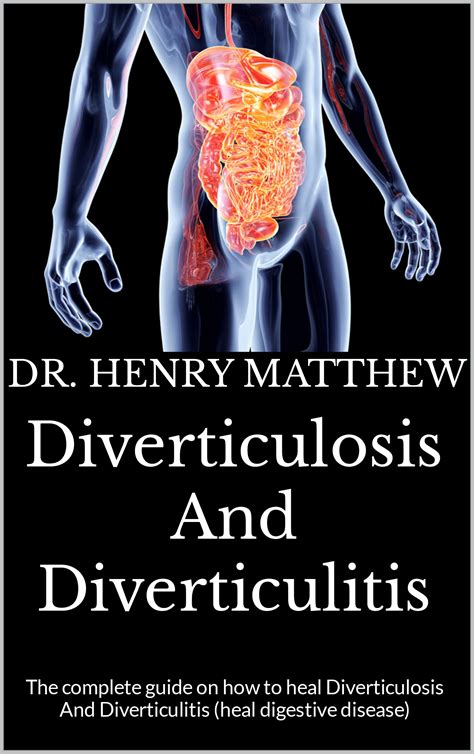 Buy Diverticulosis And Diverticulitis The Complete Guide On How To