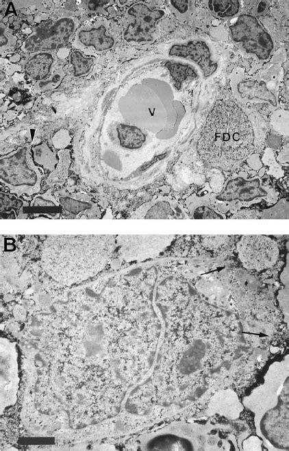 A Low Power Electron Micrograph Demonstrating Ca Capture In