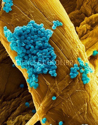 Strep Throat Bacteria Under Microscope