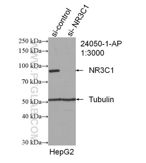 Glucocorticoid Receptor Rabbit Anti Human Mouse Rat Polyclonal