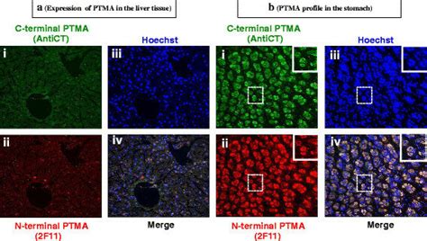 Immunohistochemical Examination Of Ptma Expression Levels In A Mouse