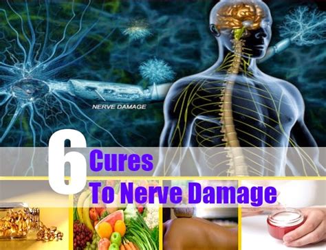 6 Cures To Nerve Damage ~ Mzizi Mkavu