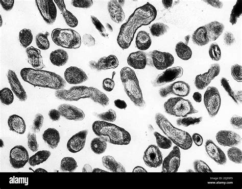 Coxiella Burnetii Bacteria Stock Photo Alamy